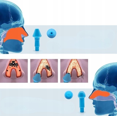 Irygator Zestaw do Irygacji Nosa i Zatok + 60 Saszetek Soli (Zestaw XXL)