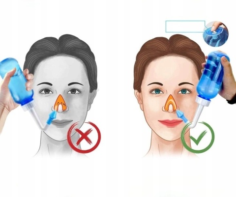 Irygator Zestaw do Irygacji Nosa i Zatok + 60 Saszetek Soli (Zestaw XXL)