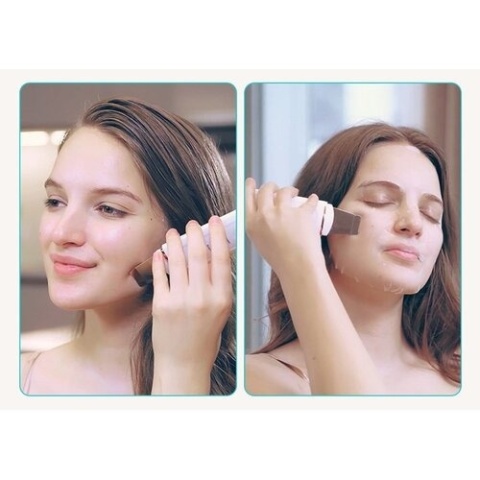 Ultradźwiękowy peeling do skóry Oczyszczanie porów STYLPRO